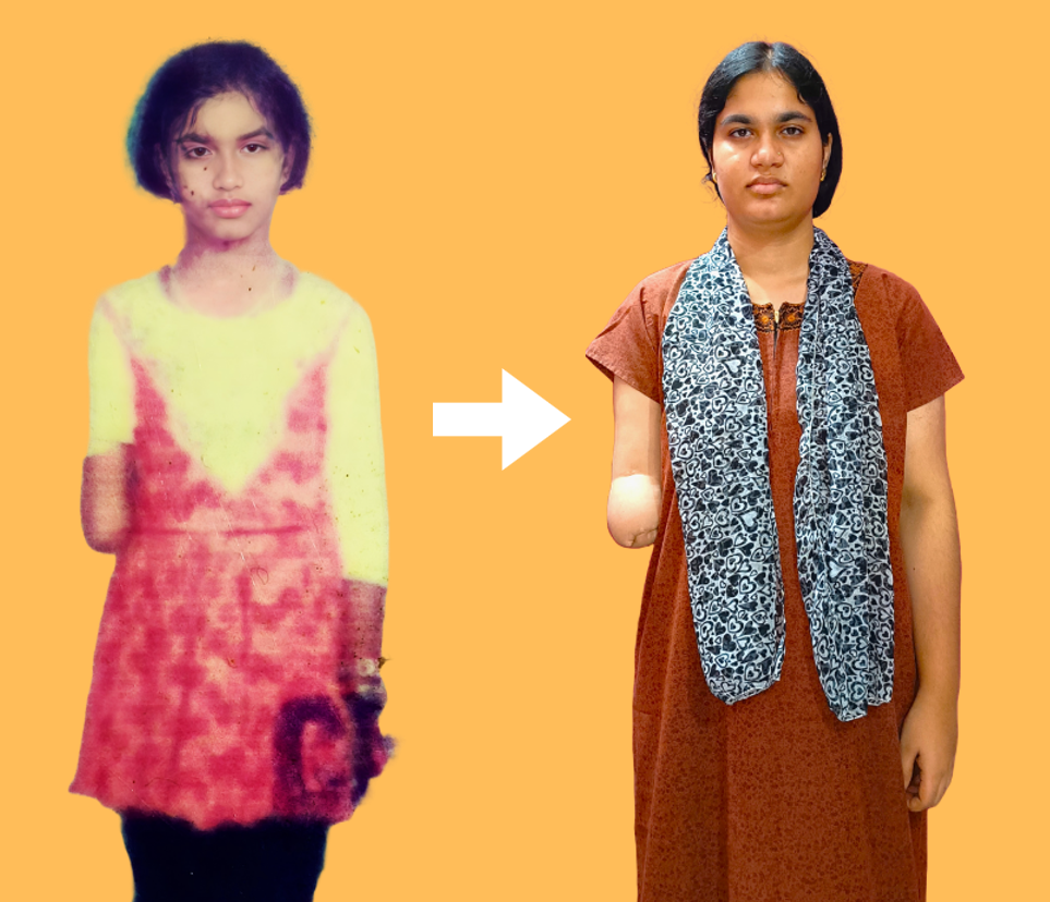 Shaheen - BRHM patient